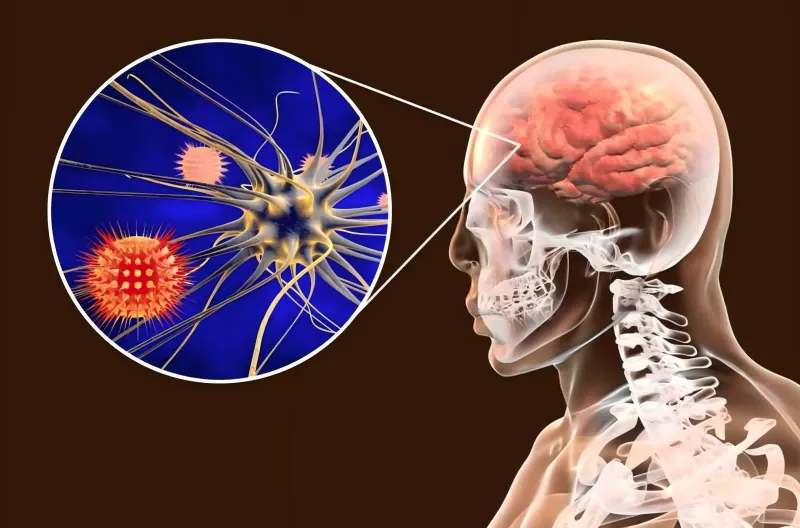 دليل لقاح المكورات السحائية